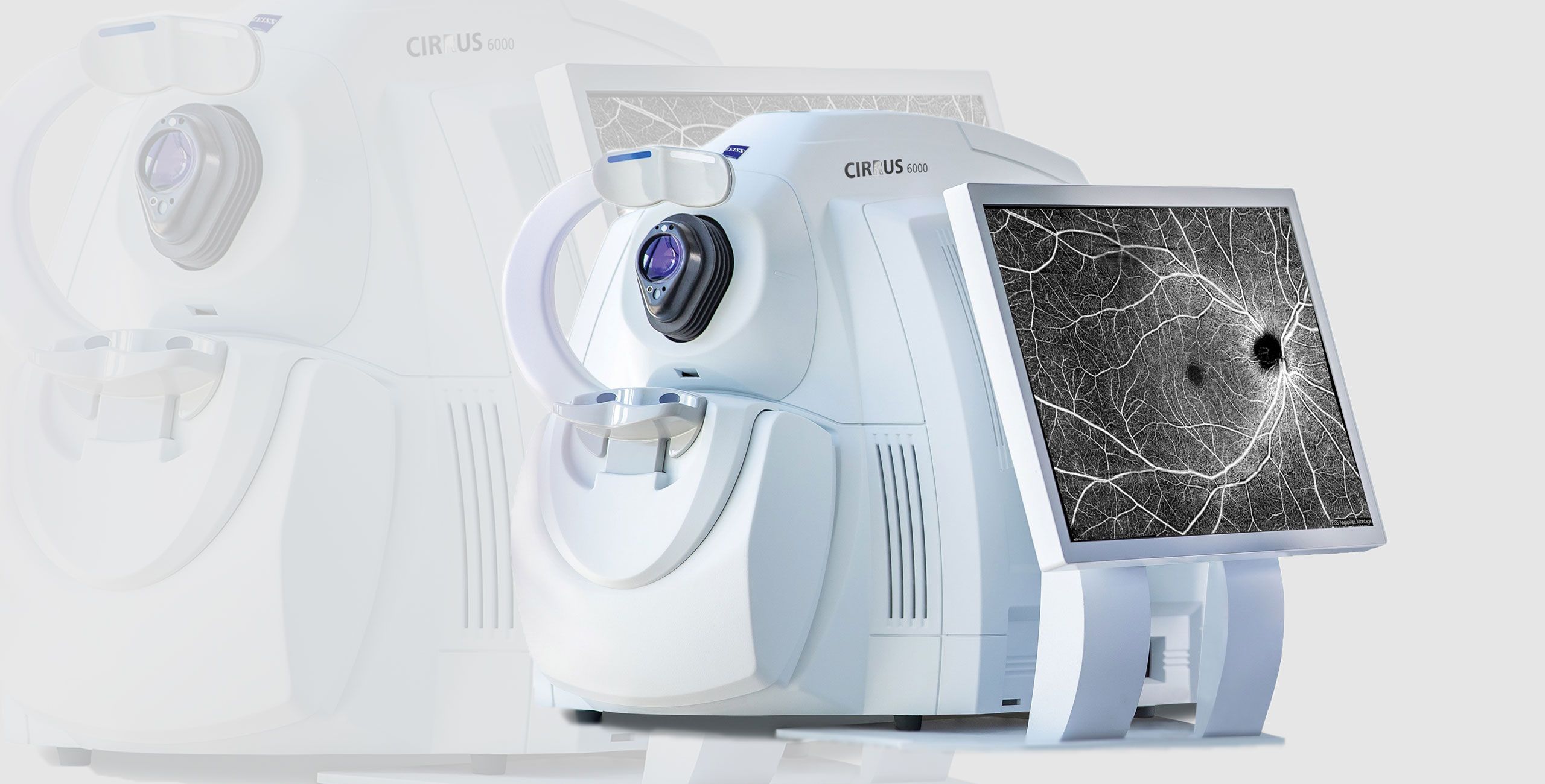 La Tomographie à Cohérence Optique - Centre ophtalmologique COSS Brétigny-sur-Orge - Essoune